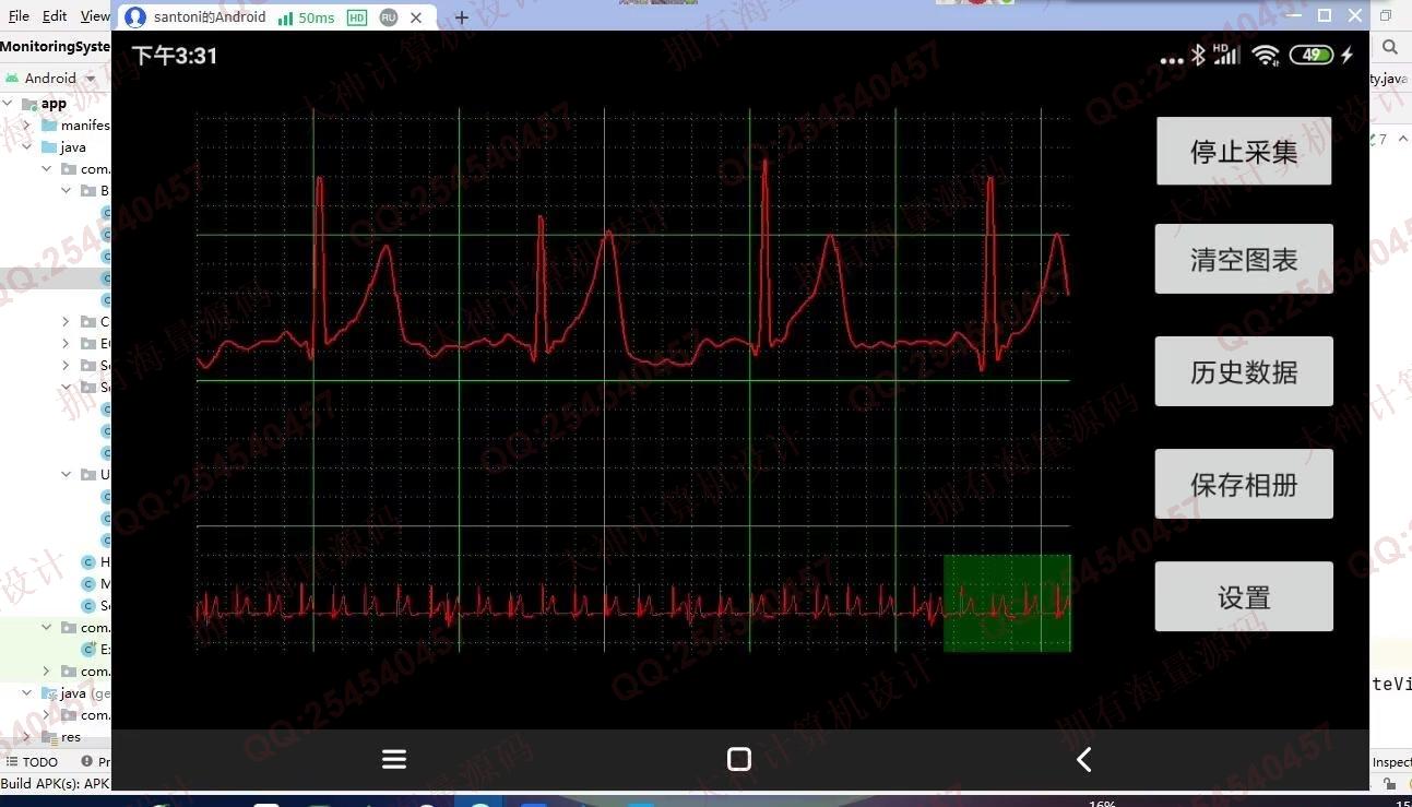 计算机源码设计实例-1411基于STM32心电图监测蓝牙传输app设计截图