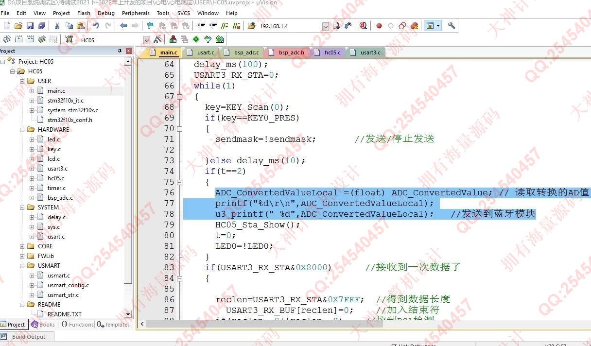 计算机源码设计实例-1411基于STM32心电图监测蓝牙传输app设计截图